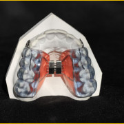 Haas-avec-coussin-occlusal