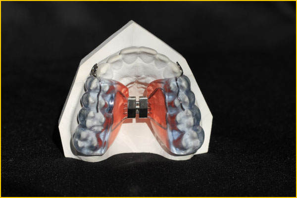 Haas-avec-coussin-occlusal