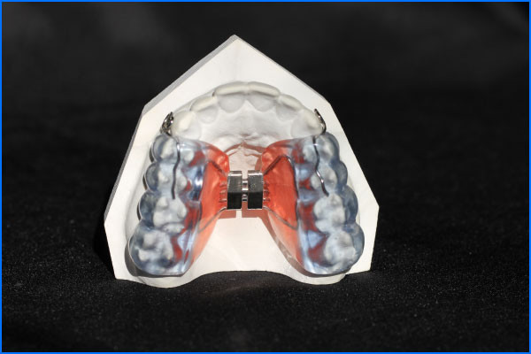 Haas-avec-coussin-occlusal